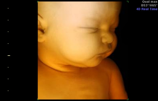 Снимок 4Д УЗИ при беременности