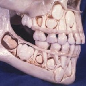 Виды диагностики рентгена зубов ребенка
