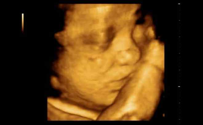 Снимок 3Д узи на 29 неделе беременности