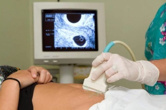 Проведение УЗИ беременной