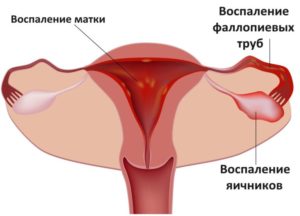 Аномалии развития матки и фаллопиевых труб,