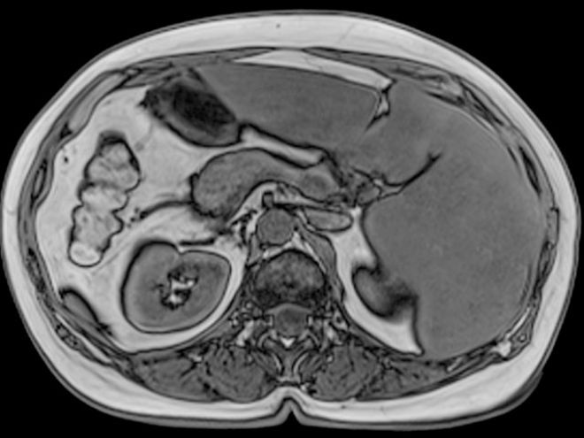 Снимок МРТ органов брюшной полости