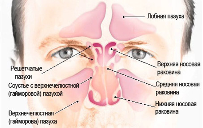 Киста в пазухе носа: возможно ли лечение без операции