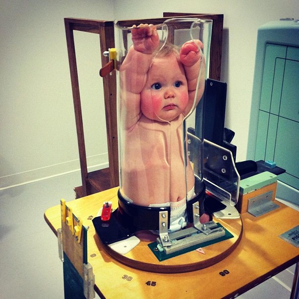 Рентген ребенку