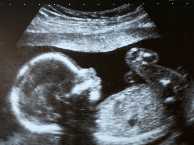 Снимок УЗИ на 34 неделе беременности