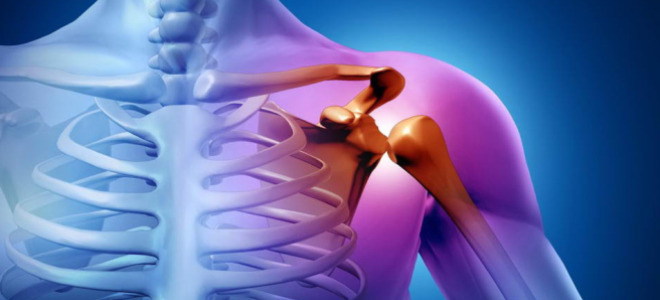 Особенности проведения и результаты КТ плечевого сустава