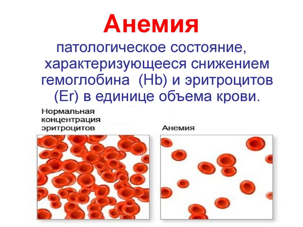 Прохождение флюорографии при месячных