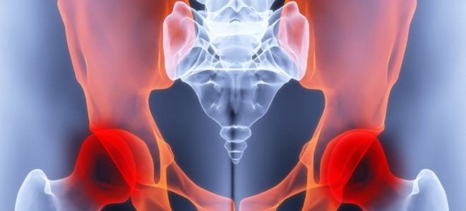 Как проводится МРТ тазобедренного сустава и что показывает это исследование