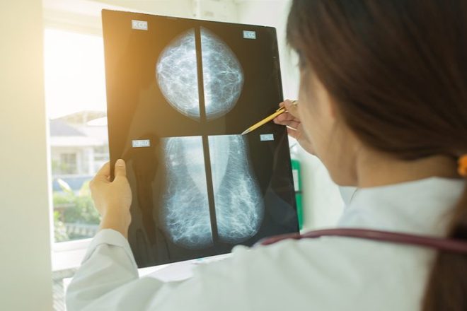 Диагноз по маммографии молочных желез