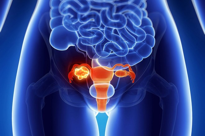 Снимок мочеполовой системы женщины