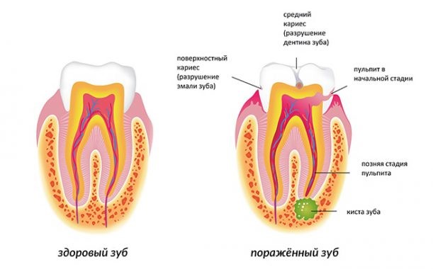Паталогии зуба