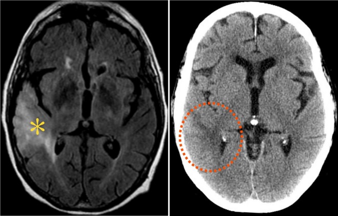 Снимок головного мозга на МРТ