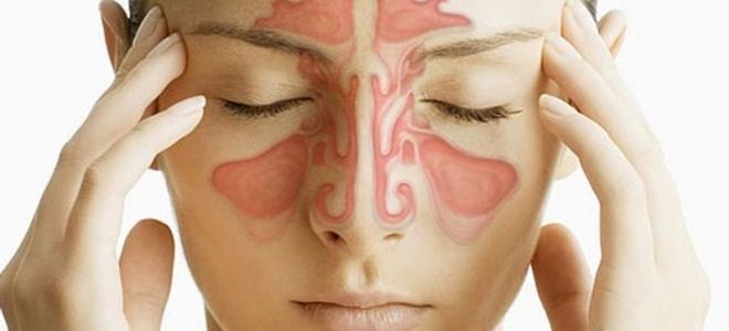 В каких случаях проводится КТ пазух носа