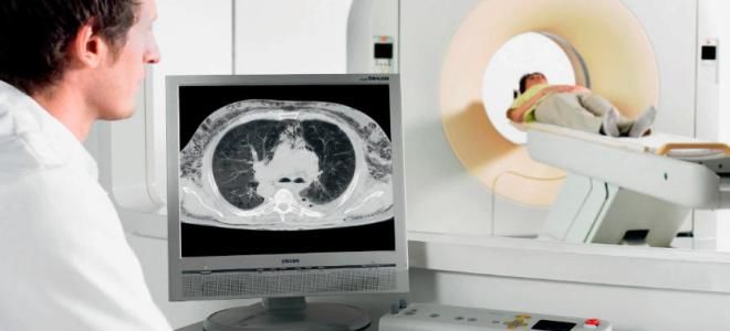 Какой метод исследования лучше: рентген или КТ?