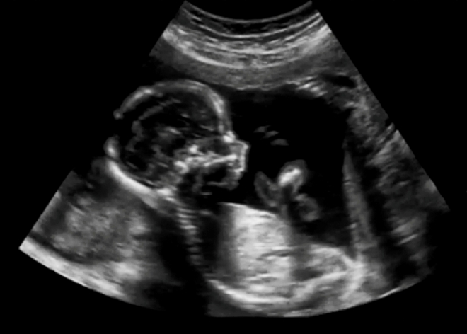 Снимок УЗИ на 16 неделе беременности