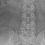 Рентген спины: особенности проведения и результаты