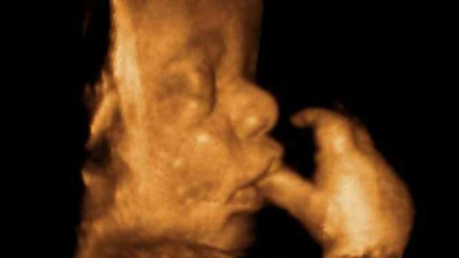 Снимок лица плода на 3Д УЗИ при беременности