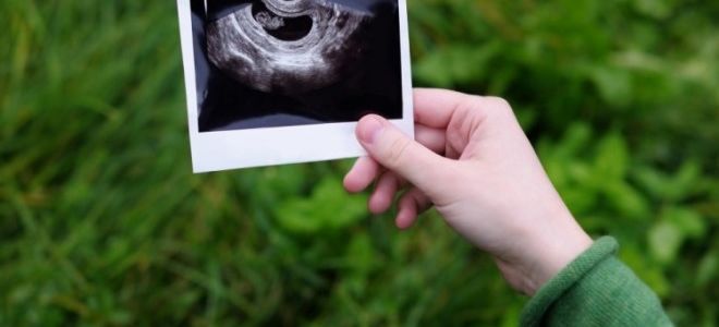 Особенности проведения УЗИ на 6 неделе беременности