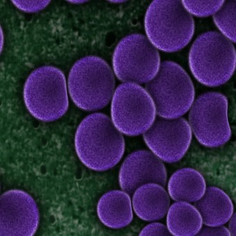 Стрептококки и стафилококки - главные «виновники» бактериальной ангины