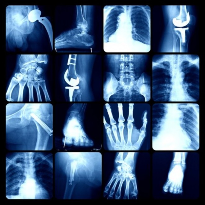 Рентгеновские снимки различных органов