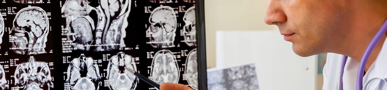 Рентгенография черепа: показания и особенности проведения исследования