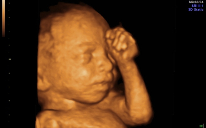 Снимок плода на 3Д УЗИ на 28 неделе беременности