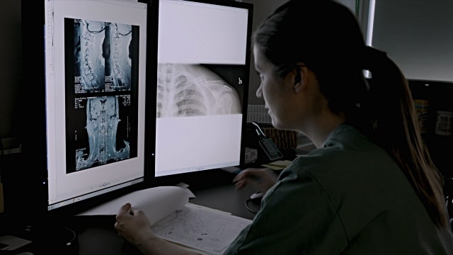 Цифровая рентгенография: преимущества и значение диагностики