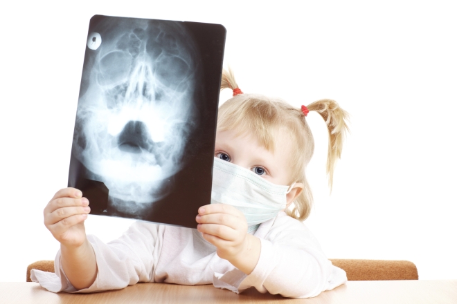 Девочка с рентгеновским снимком черепа