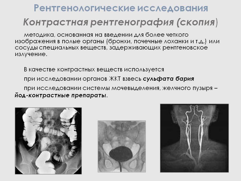 Рентген пояснично-крестцового отдела позвоночника: подготовка