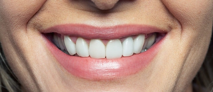 МРТ с имплантами зубов: разрешенные металлы, противопоказания