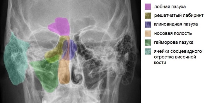 На фото рентгена здорового человека при подбородочной проекции снимка отображается треугольное просветение – это полость носа, она разделена тонкой затемненной полоской костной перегородки.