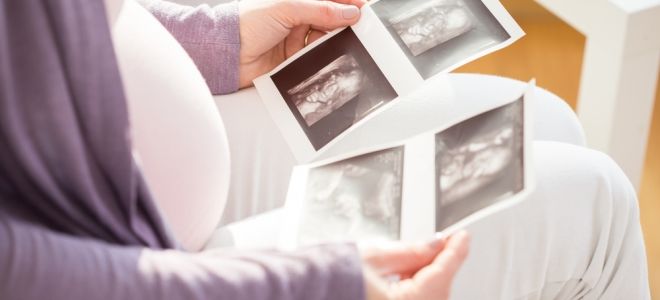 О чем расскажет УЗИ на 22 неделе беременности