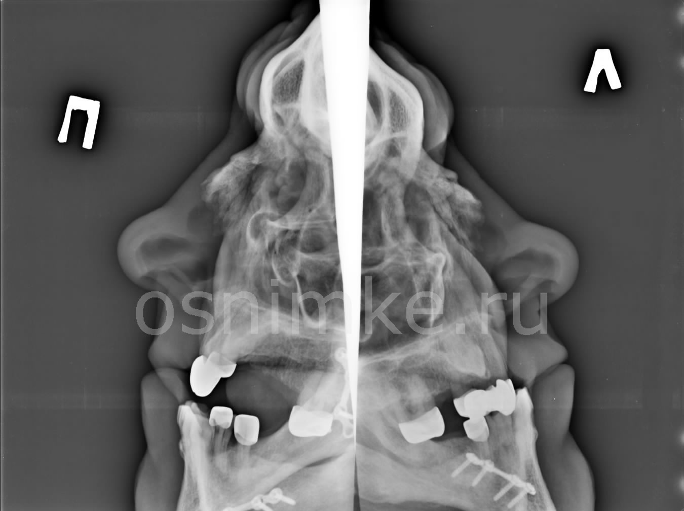 Рентгеновский снимок зубов