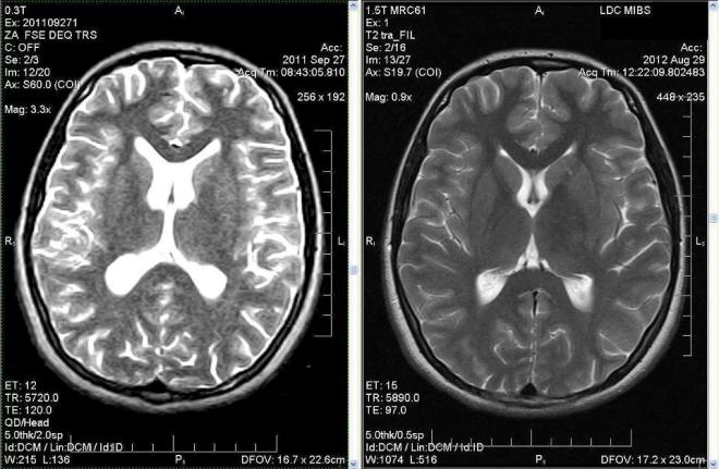 Снимки МРТ и КТ головного мозга