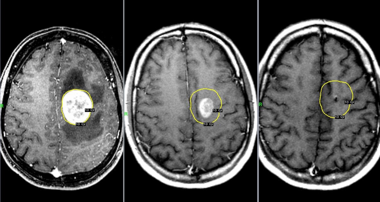 Отличия ЭЭГ и МРТ при обследовании головного мозга