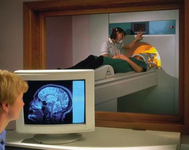 Головной мозг на мониторе при МРТ