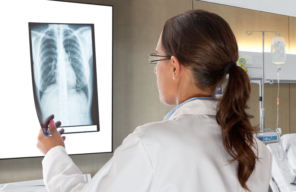 Рентген при месячных: влияние на организм