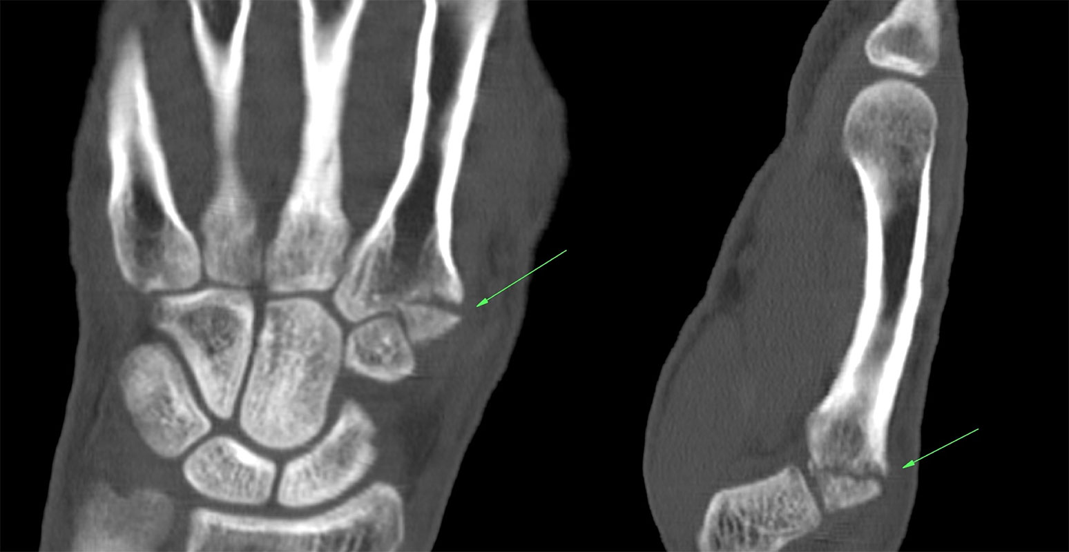 МР-диагностика руки: показания, альтернативы