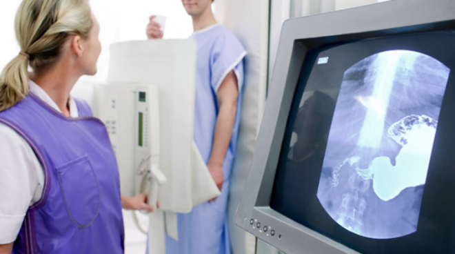 Рентген органов брюшной полости