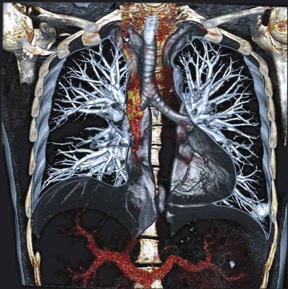 МРТ лёгких: альтернативные и инновационные методики