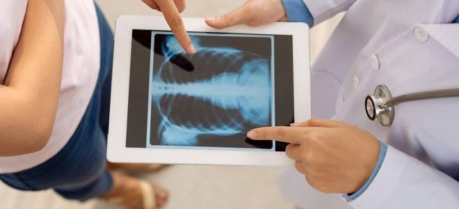 Зачем нужен рентген здоровых легких